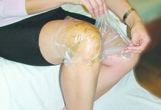 kompres na kolano w przypadku artrozy