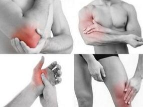 ból stawów rąk i nóg